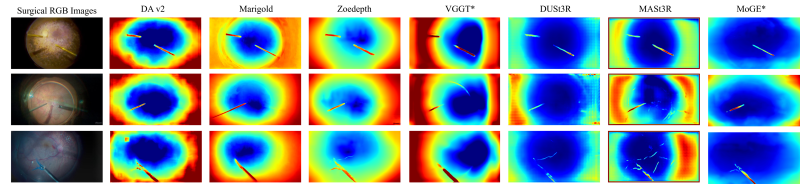 RetinalDepth surgical depth-estimation results